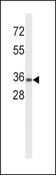 UPK1A Antibody (C-term)