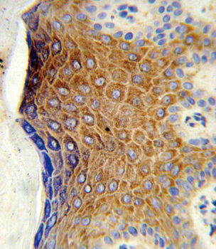 GALNT3 Antibody (Center)