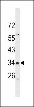 S39A3 Antibody (Center)