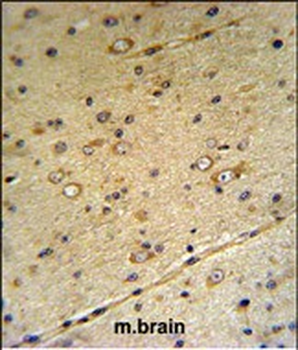 S39A3 Antibody (Center)