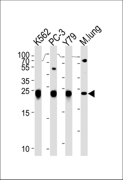 GSTP1 Antibody (Center)