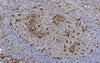 GSTP1 Antibody (Center)