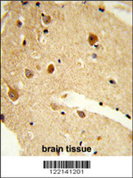 CNDP1 Antibody (C-term)