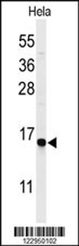 GABARAPL1 Antibody