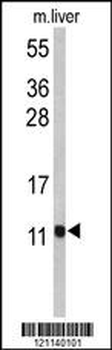 PCBD1 Antibody (Center)