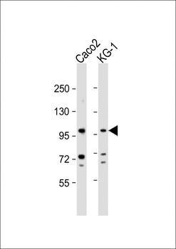 CSF3R Antibody (Center)