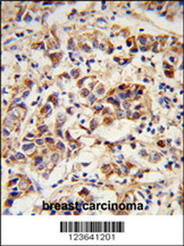 SPRR1B Antibody (C-term)