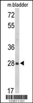 RABAC1 Antibody (N-term)
