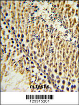 EXTL3 Antibody (N-term)