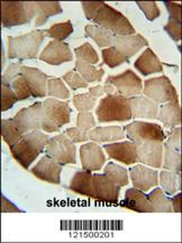 CFB Antibody (Center)