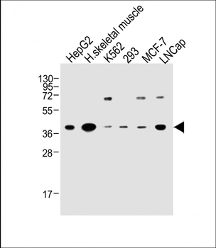 OR2H2 Antibody (C-term)