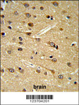 DPP10 Antibody (Center)