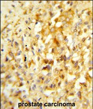 NKX3-1 Antibody (Center)