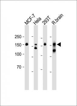 CLIP1 Antibody (N-term)