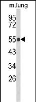GC Antibody (Center)
