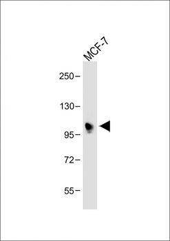 INPP4B Antibody (Center)