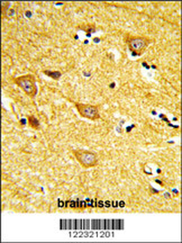 INPP4B Antibody (Center)