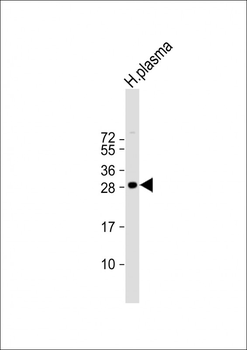C1QB Antibody (N-term)