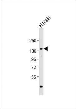 ADCY8 Antibody (Center)