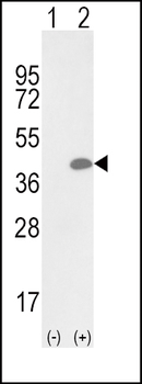 OLR1 Antibody (Center)