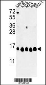 HIST1H2AH Antibody (N-term)
