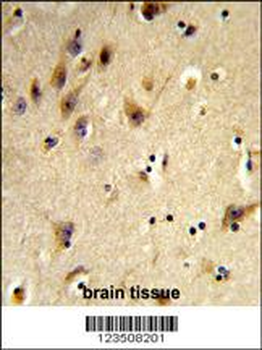 HIST1H2AH Antibody (N-term)