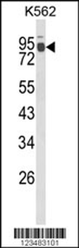 IL1RAPL2 Antibody (Center)