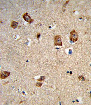 ITGA1 Antibody (Center)