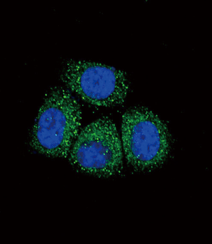 SCNN1A Antibody (Center)