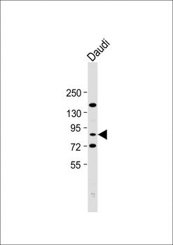 SCNN1A Antibody (Center)