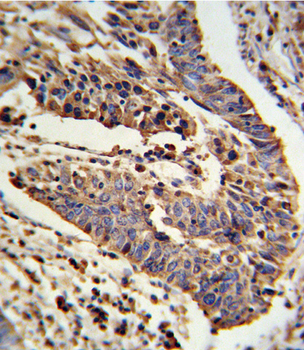 SCNN1A Antibody (Center)