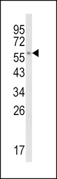CYP8B1 Antibody (C-term)