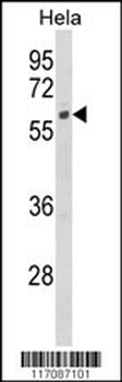 CYP7B1 Antibody (Center)