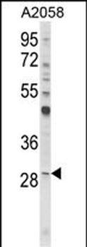 CD151 Antibody (Center)