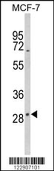 DIO2 Antibody (Center)