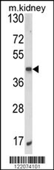 ALKBH3 Antibody (C-term)
