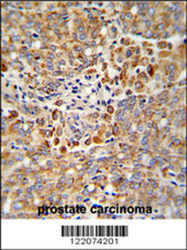 ALKBH3 Antibody (C-term)