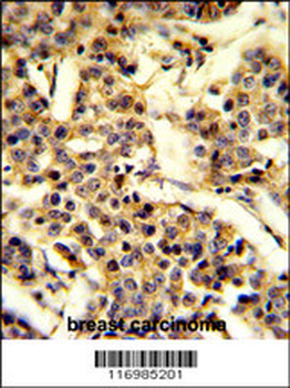 CYP2A13 Antibody (C-term)