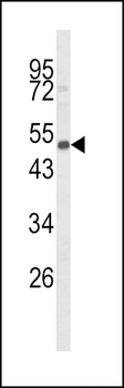 CYP24A1 Antibody (C-term)