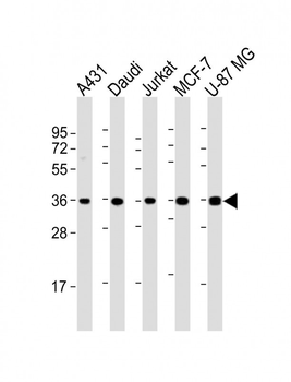 MICA Antibody (Center)