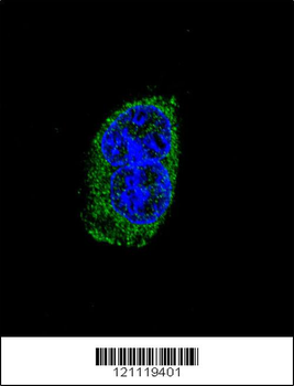 TSHB Antibody (Center)