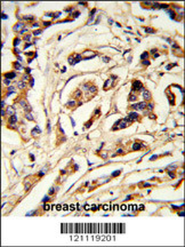 TSHB Antibody (Center)