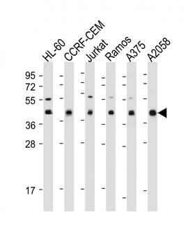 HLA-B Antibody (N-term)