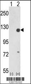 PTK2 Antibody (Center)