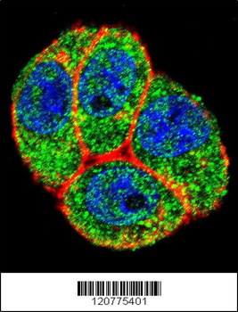 PTK2 Antibody (Center)