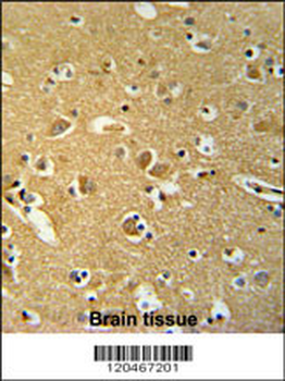 HSPC142 Antibody (N-term)