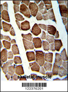 ATP5O Antibody (N-term)