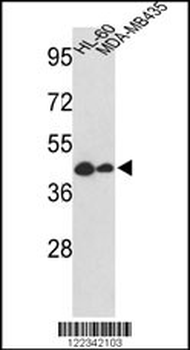 GSDMB Antibody (Center)