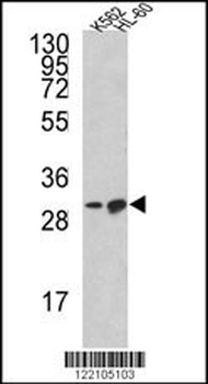 BCL2L11 Antibody (Center)