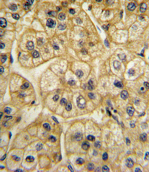 AP2A2 Antibody (Center)